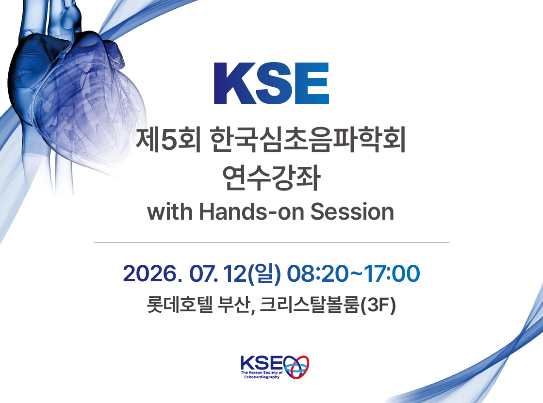 KSE